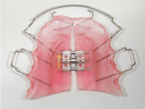 取り外し可能な、子どもの顎を拡大する矯正装置