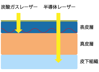 到達度の違い